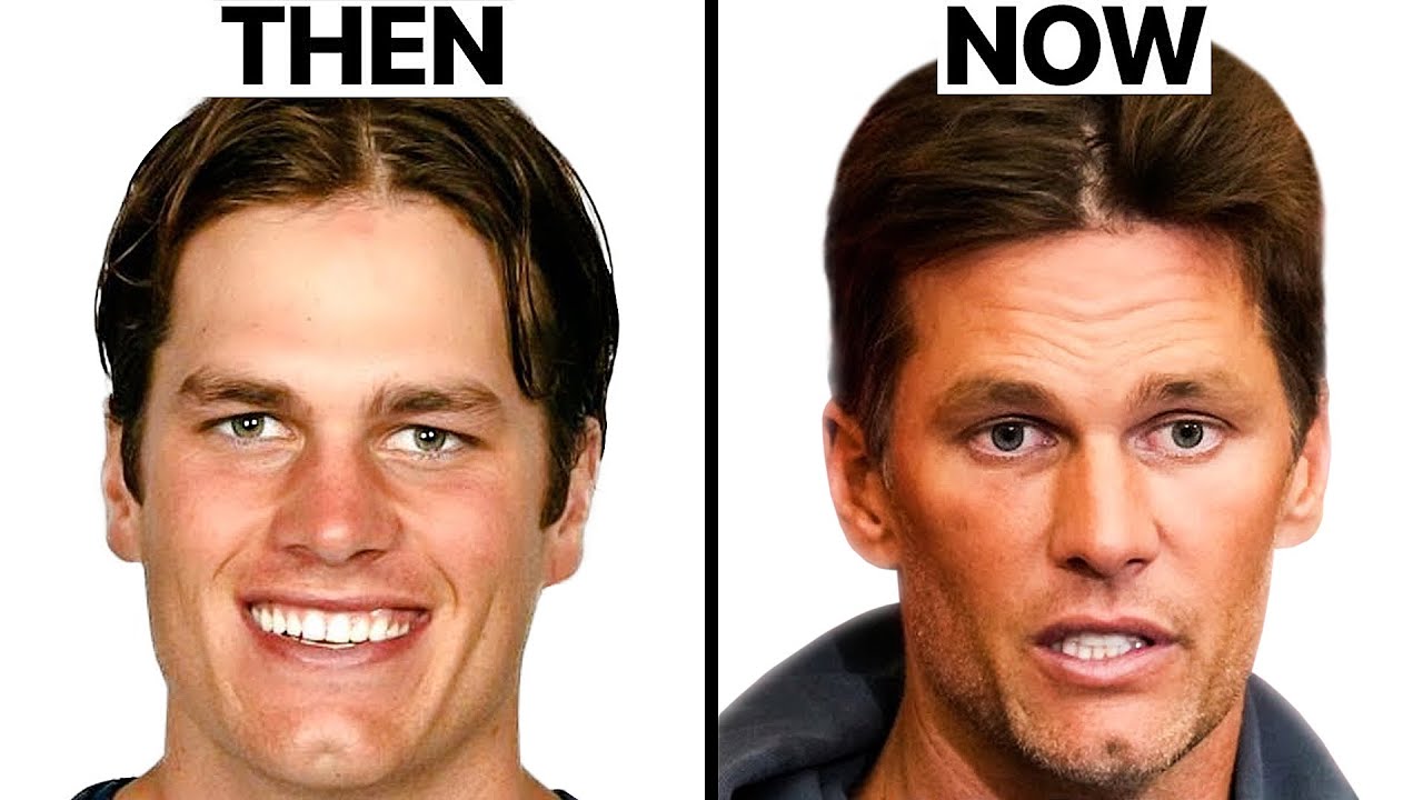 Did Tom Brady have Plastic Surgery? | Surgeon Reacts