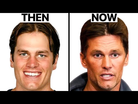 Did Tom Brady have Plastic Surgery? | Surgeon Reacts