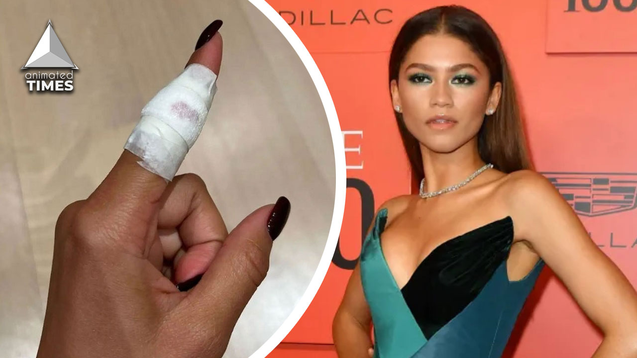 ‘Had Cat Scratches Worse Than This’: Fans Call Out Zendaya for Making Mountain Out of a Molehill Over Minor Cooking Accident, Ask Her to Stop Her Gen Z Overacting