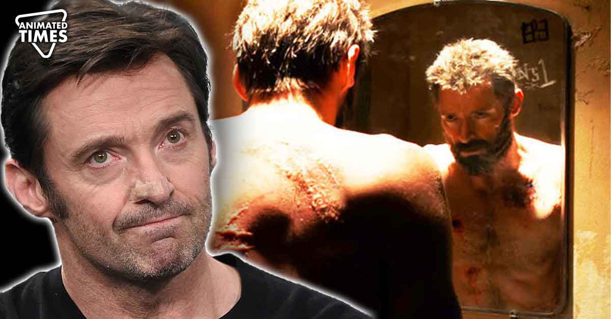 What is Basal Cell Carcinoma – Hugh Jackman’s Curable Skin Cancer Explained as Actor Shares Saddening Health Update