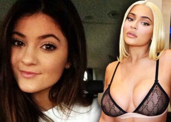 Kylie Jenner Accused of Lying to Fans About Her Plastic Surgery