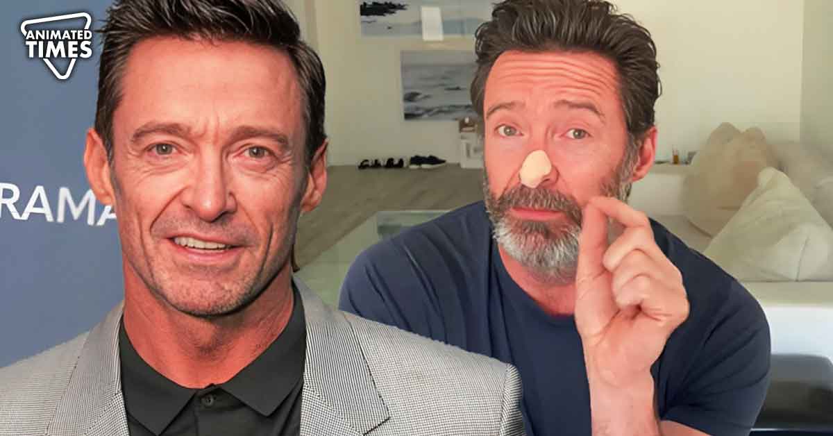 "Wear sunscreen, it's not worth it": After Concerning Skin Cancer, Hugh Jackman Requests His Fan to Take Precautions