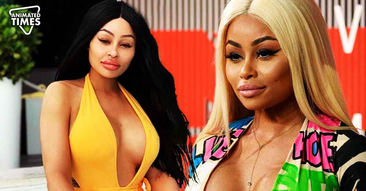 “Please don’t even do the fillers, it’s not worth it”: Blac Chyna Regrets Her Obsession With Beauty, Vows to Dissolve Fillers From Her Face