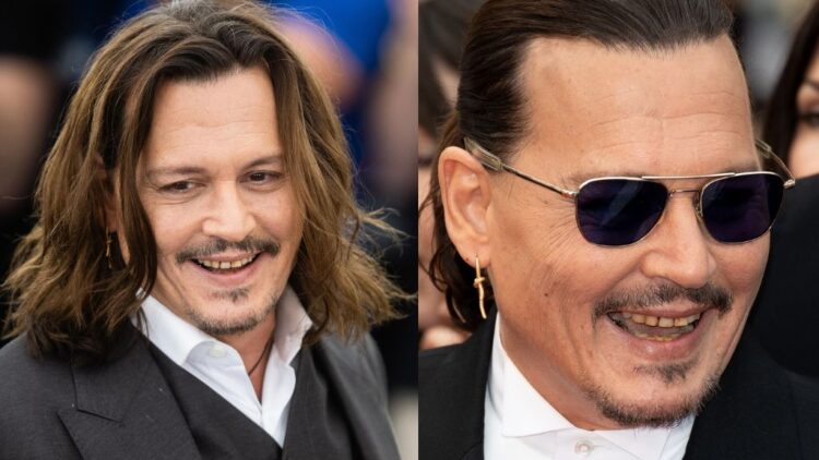 Medical Expert Reveals Truth Behind Johnny Depp's Viral Rotting Yellow ...