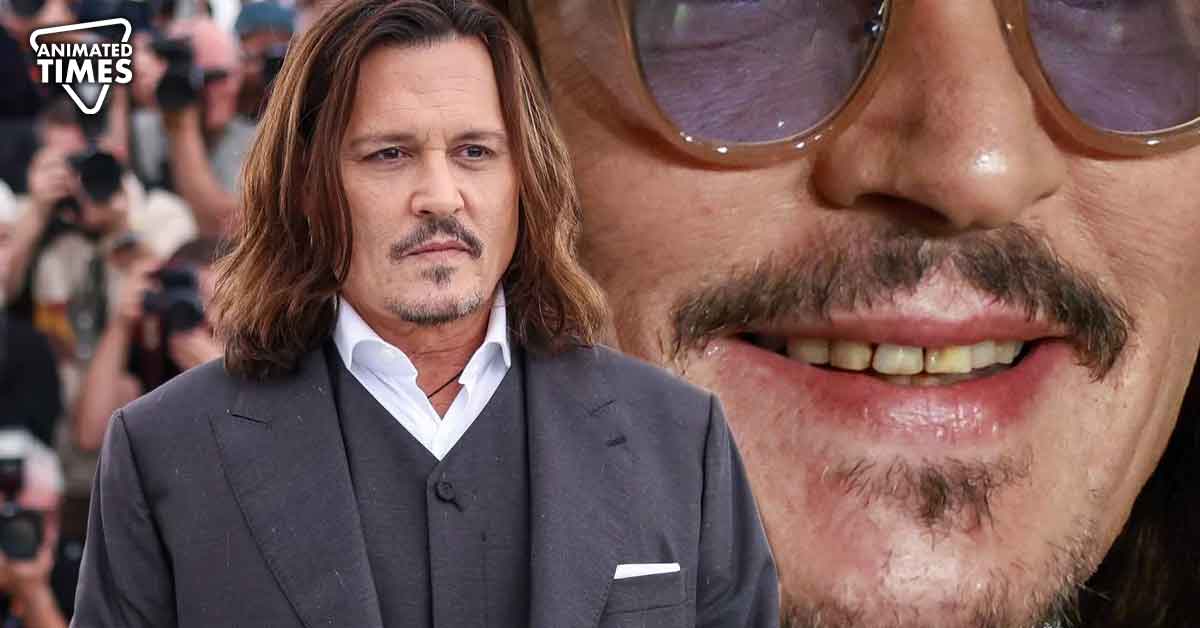 Medical Expert Reveals Truth Behind Johnny Depp’s Viral Rotting Yellow Teeth at Cannes 2023